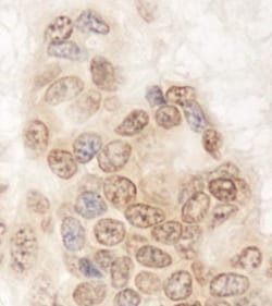 QSER1 Antibody, Novus Biologicals 0.1mL; Unlabeled:Antibodies, Polyclonal